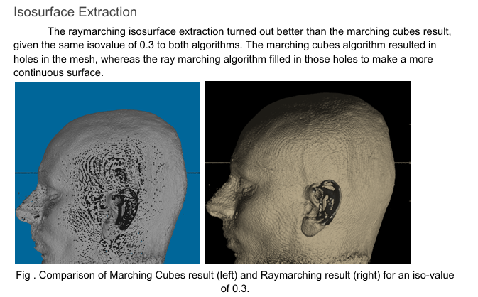 MRI-head-isosurface
